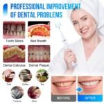 (ON SALES) RECHARGEABLE ULTRASONIC DENTAL CALCULUS REMOVER,TEETH WHITENING,TARTAR REMOVER ORAL IRRIGATOR(Comes with 3 replaceable brush,2 different medical steel cleaning head,mouth mirror) - Image 5