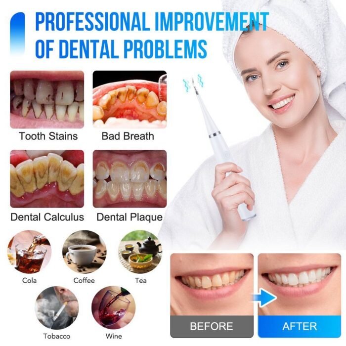 (ON SALES) RECHARGEABLE ULTRASONIC DENTAL CALCULUS REMOVER,TEETH WHITENING,TARTAR REMOVER ORAL IRRIGATOR(Comes with 3 replaceable brush,2 different medical steel cleaning head,mouth mirror) - Image 5