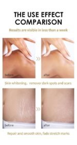 (ON SALES) EXTRA STRONG PEELING OIL FOR WHITEN AND SMOOTHEN SKIN 110ML - Image 6