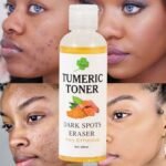 (ON SALES) TURMERIC DARK SPOT REMOVING TONER 100ml - Image 5