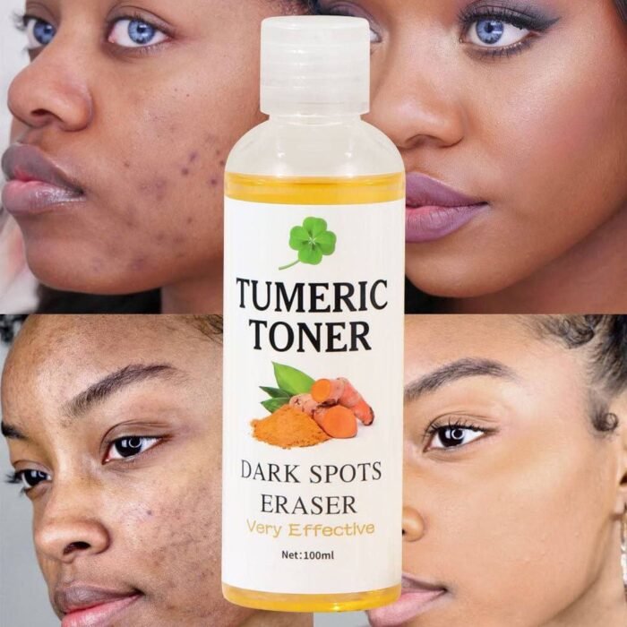 (ON SALES) TURMERIC DARK SPOT REMOVING TONER 100ml - Image 5