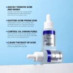 (ON SALES) SALICYLIC ACID FACE SERUM - Image 4