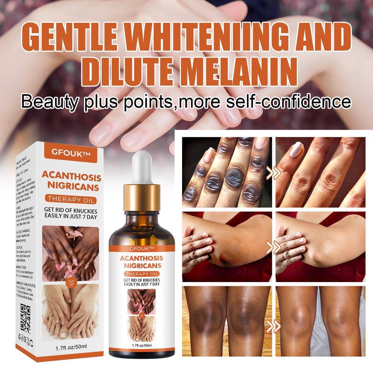 img_1645 DARK KNUCKLE WHITENING SERUM - SUPERB SKIN RESTORATION THERAPY OIL (50ML) not 30ml - Image 1