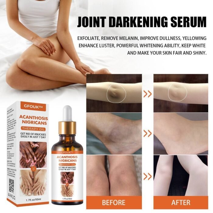 DARK KNUCKLE WHITENING SERUM - SUPERB SKIN RESTORATION THERAPY OIL (50ML) not 30ml - Image 2