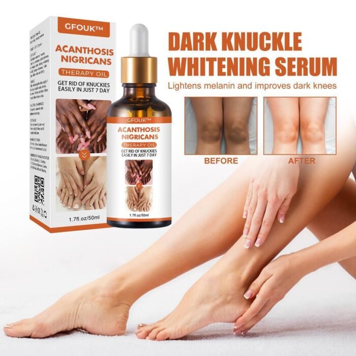DARK KNUCKLE WHITENING SERUM - SUPERB SKIN RESTORATION THERAPY OIL (50ML) not 30ml - Image 3
