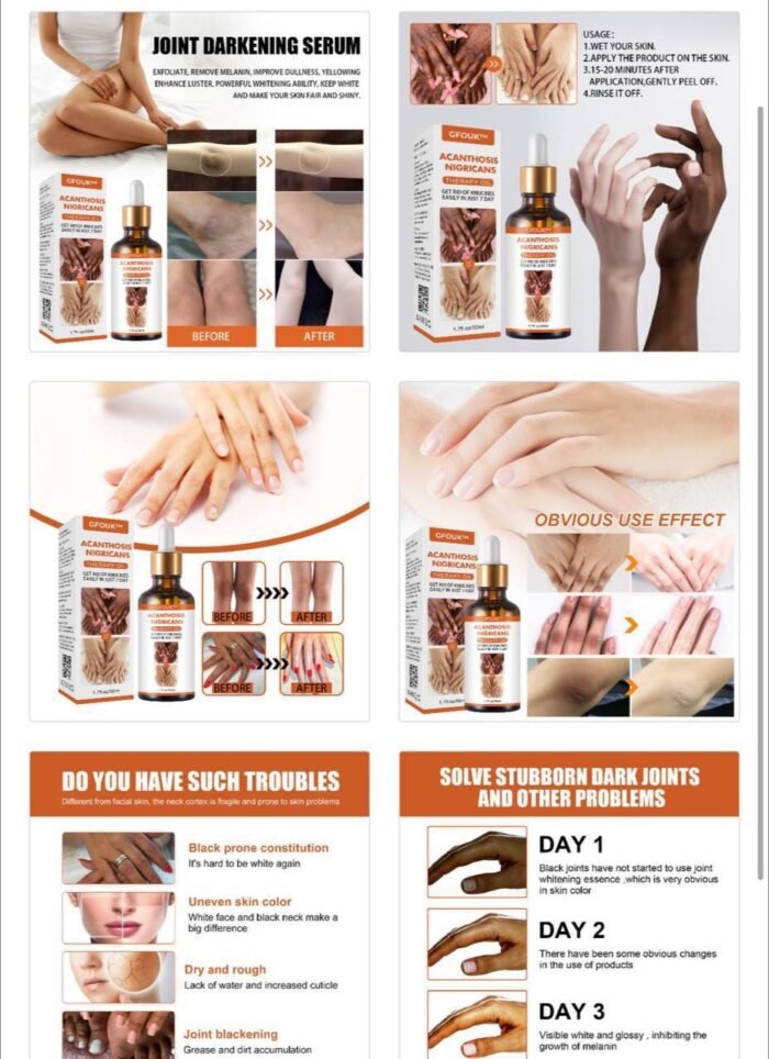 DARK KNUCKLE WHITENING SERUM - SUPERB SKIN RESTORATION THERAPY OIL (50ML) not 30ml - Image 5